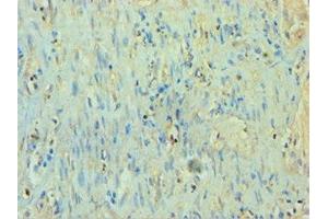 Immunohistochemistry of paraffin-embedded human epityphlon tissue using ABIN7166926 at dilution of 1:100 (TP53I3 抗体  (AA 163-332))