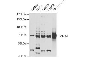 Western blot analysis of extracts of various cell lines, using  antibody (ABIN6129895, ABIN6136754, ABIN6136756 and ABIN6222177) at 1:1000 dilution. (ALAS1 抗体  (AA 1-250))