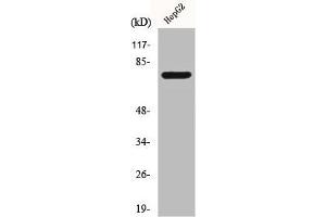 Western Blot analysis of Jurkat cells using CLIP4 Polyclonal Antibody (CLIP4 抗体  (Internal Region))