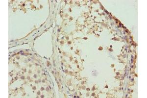 Immunohistochemistry of paraffin-embedded human testis tissue using ABIN7176109 at dilution of 1:100 (ZNF131 抗体  (AA 80-379))
