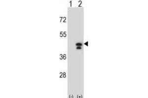 Western Blotting (WB) image for anti-Phosphoglycerate Kinase 1 (PGK1) antibody (ABIN2995252) (PGK1 抗体)
