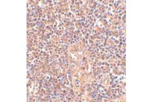 Immunohistochemistry of ATM in human lymph node tissue with ATM polyclonal antibody  at 2. (ATM 抗体  (C-Term))