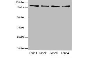 Western blot analysis of (1) HeLa whole cell lysate, (2) Mouse heart tissue, (3) HepG-2 whole cell lysate and (4) Jurkat whole cell lysate, using TNNI3K antibody (4. (TNNI3K 抗体  (AA 1-75))