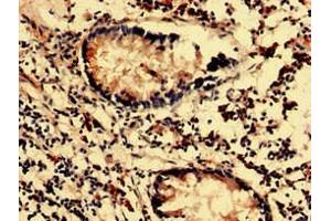 Immunohistochemistry analysis of human appendix tissue using ABIN7143903 at dilution of 1:100 (MAN2C1 抗体  (AA 746-969))