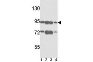 Western blot analysis of ABCB5 antibody and 1) A375, 2) K562, 3) A2058 and4)  HL-60 lysate. (ABCB5 抗体  (AA 1-30))