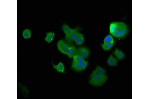 Immunofluorescence staining of MCF-7 cells with ABIN7173373 at 1:400, counter-stained with DAPI. (TCHP 抗体  (AA 1-498))