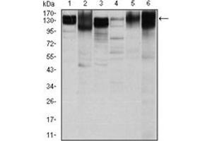 Western Blotting (WB) image for anti-Integrin beta 1 (ITGB1) antibody (ABIN1106231) (ITGB1 抗体)