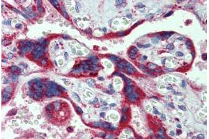 Immunohistochemistry (Formalin-fixed Paraffin-embedded Sections) (IHC (fp)) image for anti-Cytochrome P450, Family 11, Subfamily A, Polypeptide 1 (CYP11A1) (AA 288-337) antibody (ABIN6744438)