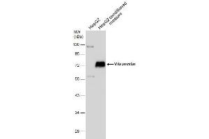 WB Image HepG2 whole cell extract and conditioned medium (30 μg) were separated by 10% SDS-PAGE, and the membrane was blotted with Vitronectin antibody , diluted at 1:1000. (Vitronectin 抗体)
