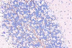 Immunohistochemistry of paraffin-embedded human brain using ARMET/ARP/MANF Rabbit pAb (ABIN6129561, ABIN6143461, ABIN6143463 and ABIN6222775) at dilution of 1:50 (40x lens). (MANF 抗体  (AA 25-182))
