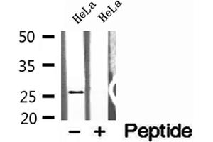 Western blot analysis of extracts of HeLa cells, using NUDT21 antibody. (NUDT21 抗体  (Internal Region))
