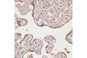 Immunohistochemistry of paraffin-embedded human placenta using Thioredoxin reductase 1 (Thioredoxin reductase 1 (TXNRD1 ) ) antibody (ABIN7270806) at dilution of 1:100 (40x lens). (TXNRD1 抗体)