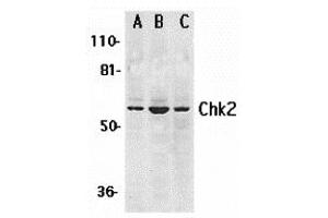 Western Blotting (WB) image for anti-Checkpoint Kinase 2 (CHEK2) (N-Term) antibody (ABIN1031318) (CHEK2 抗体  (N-Term))
