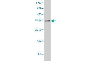 Western Blot detection against Immunogen (44. (CABP4 抗体  (AA 1-170))