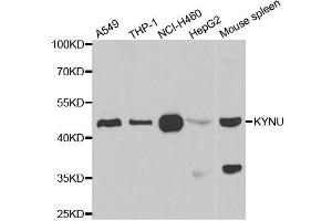 Western blot analysis of extracts of various cell lines, using KYNU antibody. (KYNU 抗体  (AA 1-307))