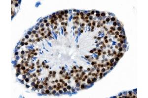 IHC analysis of PTBP2 using anti-PTBP2 antibody (ABIN7599453). (PTBP2 抗体  (AA 1-504))