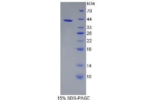 Image no. 1 for alpha Ketoglutarate Dehydrogenase (alphaKGDHC) (AA 256-582) protein (His tag) (ABIN4990511)
