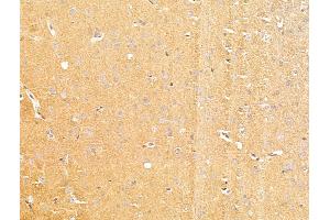 ABIN7094805 and ABIN7098856 at 1/100 staining Rat brain tissue by IHC-P.