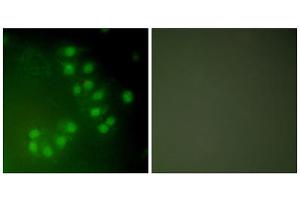 Immunofluorescence analysis of A549 cells, using p63 antibody (ABIN5976481). (TCP1 alpha/CCTA 抗体  (C-Term))