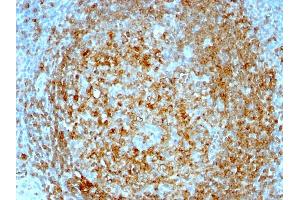 Formalin-fixed, paraffin-embedded human Tonsil stained with CD74 Mouse Monoclonal Antibody (CLIP/813). (CD74 抗体)