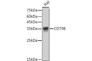 Western blot analysis of extracts of Raji cells, using CD79B antibody (ABIN1682474, ABIN3018855, ABIN3018856 and ABIN7101674) at 1:1000 dilution. (CD79b 抗体)