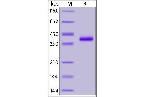 Human IL-8, Fc Tag on  under reducing (R) condition. (IL-8 Protein (AA 28-99) (Fc Tag))