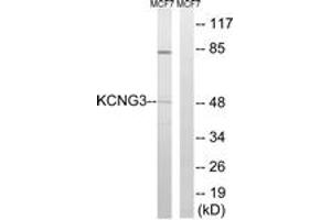 Western blot analysis of extracts from MCF-7 cells, using KCNG3 Antibody. (KCNG3 抗体  (AA 183-232))