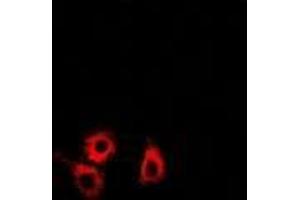 Immunofluorescence (IF) image for anti-SET and MYND Domain Containing 4 (SMYD4) (AA 1-260) antibody (ABIN6004721) (SMYD4 抗体  (AA 1-260))