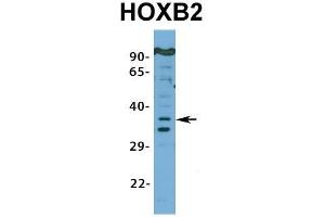 Western Blotting (WB) image for anti-Homeobox B2 (HOXB2) (N-Term) antibody (ABIN2776384)