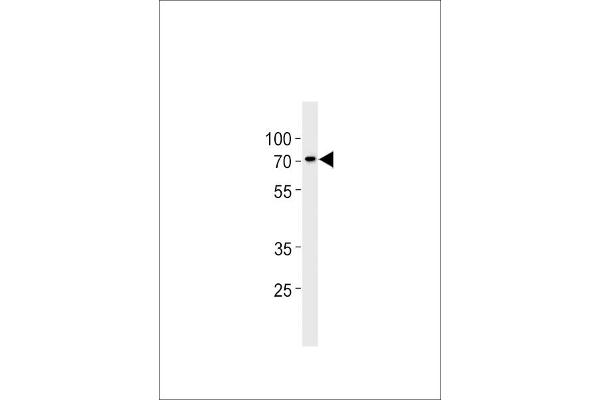 ST7L 抗体  (C-Term)