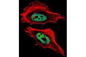 Fluorescent confocal image of HeLa cells stained with CTBP1 antibody. (CTBP1 抗体  (AA 413-440))