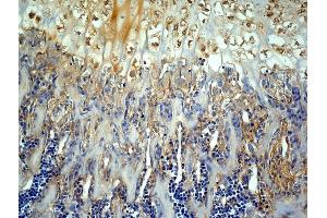 Generously provided by Markus Linder from Medical University Vienna as part of the Bioss Discovery Program. (MMP13 抗体  (AA 201-300))