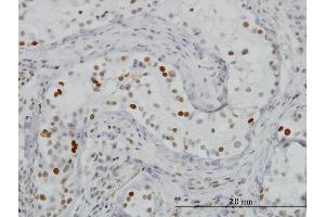 Immunoperoxidase of monoclonal antibody to BRD3 on formalin-fixed paraffin-embedded human testis. (BRD3 抗体  (AA 418-556))