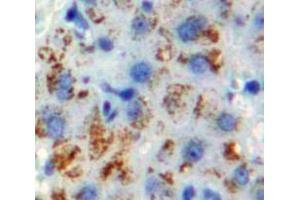 IHC-P analysis of Liver tissue, with DAB staining. (CYP1A1 抗体  (AA 1-250))