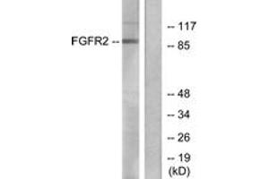 Western blot analysis of extracts from A549 cells, using FGFR2 Antibody. (FGFR2 抗体  (AA 471-520))