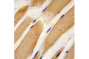 Image no. 3 for anti-Actin, Alpha, Cardiac Muscle 1 (ACTC1) (Center) antibody (ABIN357023) (ACTC1 抗体  (Center))