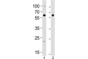 Western blot analysis of lysate from 1) human 293 and 2) mouse NIH3T3 cell line using BMPR1A antibody at 1:1000. (BMPR1A 抗体  (AA 166-196))