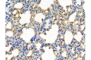 Phospho-CDK5 (Tyr239) Antibody at 1/100 staining Mouse lung tissue by IHC-P. (CDK5 抗体  (pTyr239))