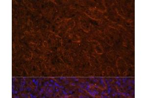 Immunofluorescence analysis of Human spleen using ICOS Polyclonal Antibody at dilution of 1:100. (ICOS 抗体)