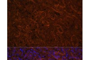 Immunofluorescence analysis of Human spleen using ICOS Polyclonal Antibody at dilution of 1:100. (ICOS 抗体)