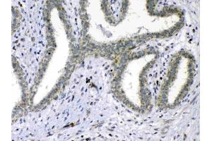IHC analysis of Cdc20 using anti-Cdc20 antibody . (CDC20 抗体)