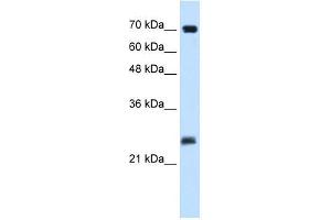 Human Placenta; WB Suggested Anti-SERTAD1 Antibody Titration: 0. (SERTAD1 抗体  (N-Term))