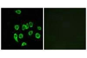 Immunofluorescence analysis of A549 cells, using MRPL32 antibody. (MRPL32 抗体)