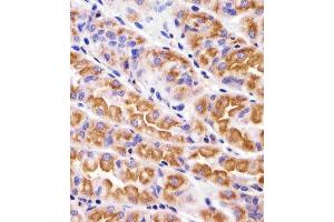 Immunohistochemical analysis of paraffin-embedded H. (VAMP8 抗体  (N-Term))