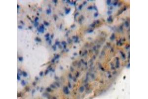 Used in DAB staining on fromalin fixed paraffin-embedded Lung tissue (ADAMTS4 抗体  (AA 437-575))