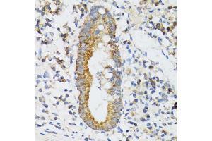 Immunohistochemistry of paraffin-embedded human vermiform appendix using SRP19 antibody (ABIN5974084) at dilution of 1/100 (40x lens). (SRP19 抗体)