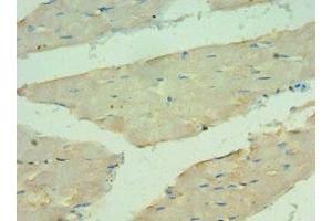 Immunohistochemistry of paraffin-embedded human skeletal muscle tissue using ABIN7144121 at dilution of 1:100 (ANGPTL4 抗体  (AA 26-406))