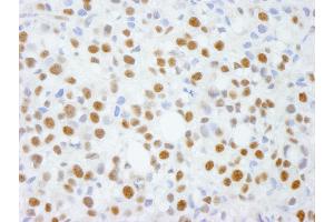 Immunohistochemistry (IHC) image for anti-Activity-Dependent Neuroprotector Homeobox (ADNP) (C-Term) antibody (ABIN7448403) (ADNP 抗体  (C-Term))