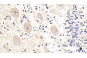 Detection of GSTM2 in Human Cerebellum Tissue using Polyclonal Antibody to Glutathione S Transferase Mu 2 (GSTM2) (GSTM2 抗体  (AA 3-218))