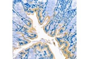 Immunohistochemistry (Paraffin-embedded Sections) (IHC (p)) image for anti-ATPase, H+/K+ Transporting, Nongastric, alpha Polypeptide (ATP12A) antibody (ABIN7073160)